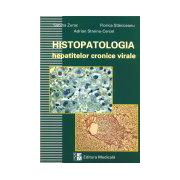 Histopatologia hepatitelor virale