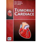 Tumorile cardiace