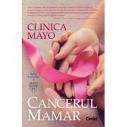 Clinica Mayo|Cancerul mamar