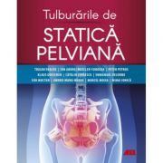 Tulburarile de statica pelviana